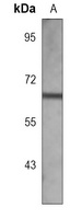 Anti-ACVR1B Antibody