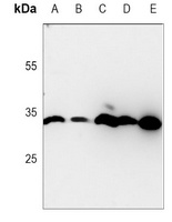 Anti-Prohibitin Antibody