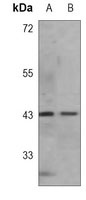 Anti-BMI1 Antibody