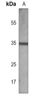 Anti-OTX2 Antibody