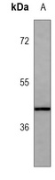 Anti-HLA-F Antibody