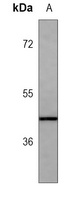Anti-HSP47 Antibody
