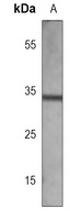 EPHB2 antibody