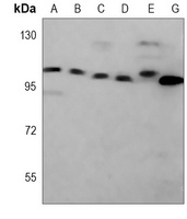 MCM3 antibody