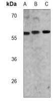 ME2 antibody