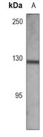 Anti-CD49f Antibody