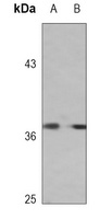 Anti-AGXT1 Antibody