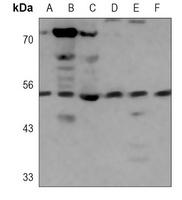Anti-H1L Antibody