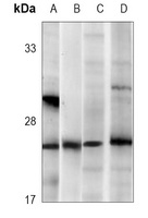 RAB3B antibody