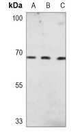 Anti-PKR Antibody