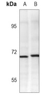 Anti-CD138 Antibody