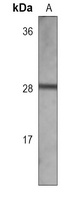 Galectin 3 antibody