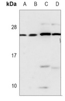 Anti-MGMT Antibody