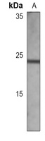 Anti-MGMT Antibody