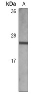 Anti-TIMP2 Antibody