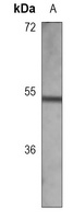 Arylsulfatase A antibody