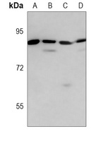 Anti-MMP9 Antibody