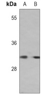 FR beta antibody