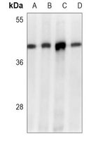 Anti-MTHFD2 Antibody