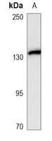 CD56 antibody