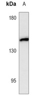 Anti-CD143 Antibody