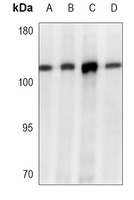 Anti-Topoisomerase 1 Antibody