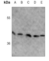 Anti-ALDOC Antibody