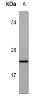 Anti-FGF4 Antibody