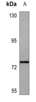 Anti-MMP2 Antibody