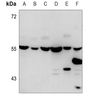 beta 5 tubulin antibody