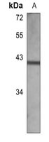 Anti-LCK Antibody