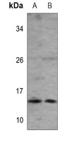 Anti-ISG15 Antibody
