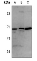 Anti-ALDH2 Antibody