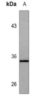 Anti-Von Willebrand Factor Antibody