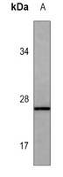 S100-B antibody