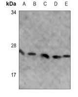 Anti-SOD2 Antibody