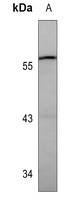 Anti-GBA Antibody
