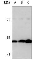 Anti-MMP1 Antibody