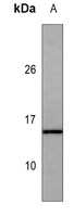 Cystatin C antibody