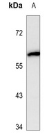 thrombin III antibody