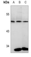 Anti-PGK1 Antibody
