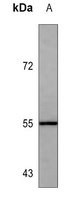 ALDH1A1 antibody