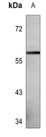 Anti-CNOT4 Antibody