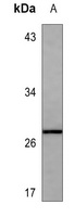 Anti-GDF11 Antibody