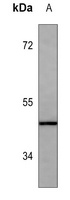 Anti-ADAMTS4 Antibody