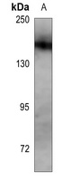 Anti-Nephrin Antibody