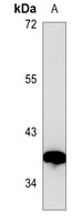 Anti-VEGFD Antibody