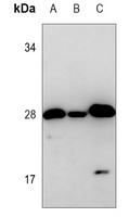 Anti-DENR Antibody