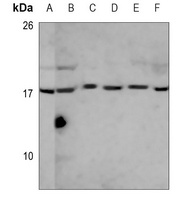 Anti-EEF1E1 Antibody