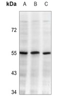 Anti-IKK beta Antibody